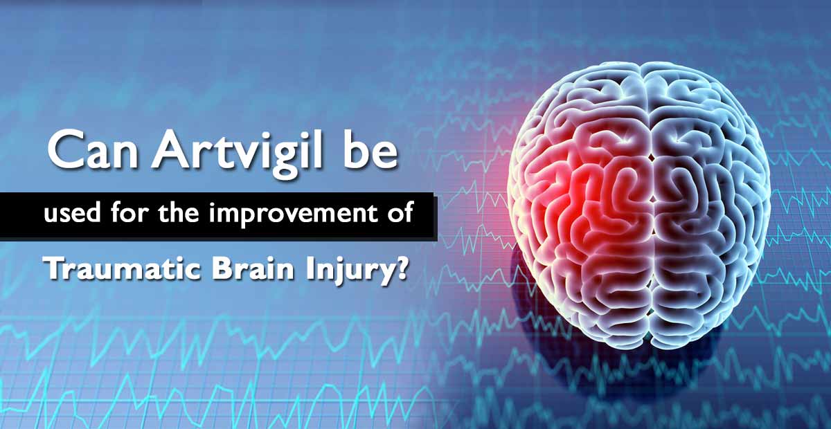 artvigil for brain